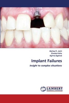 portada Implant Failures (in English)