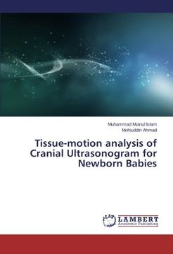 portada Tissue-Motion Analysis of Cranial Ultrasonogram for Newborn Babies
