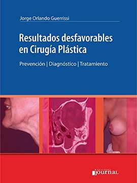 portada Resultados Desfavorables en Cirugia Plastica (in Spanish)