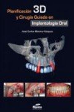 portada Planificación 3D y Cirugía Guiada en Implantología Oral