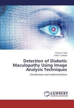 portada Detection of Diabetic Maculopathy Using Image Analysis Techniques