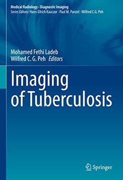 portada Imaging of Tuberculosis (in English)