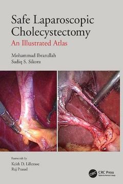 portada Safe Laparoscopic Cholecystectomy: An Illustrated Atlas (en Inglés)