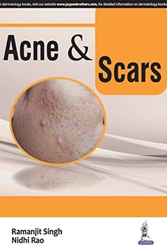 portada Acne & Scars (en Inglés)