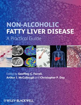 portada Non - Alcoholic Fatty Liver Disease: A Practical Guide