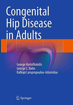 portada Congenital Hip Disease in Adults (in English)