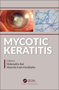 portada Mycotic Keratitis (in English)