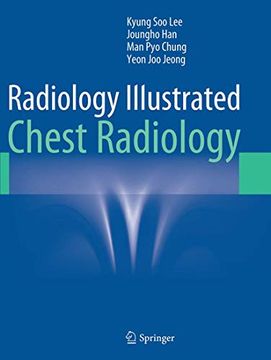portada Radiology Illustrated: Chest Radiology (en Inglés)
