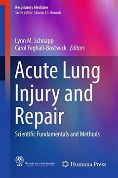 portada Acute Lung Injury and Repair: Scientific Fundamentals and Methods (Respiratory Medicine) (en Inglés)