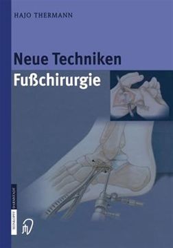 portada Neue Techniken Fusschirurgie -Language: German (en Alemán)