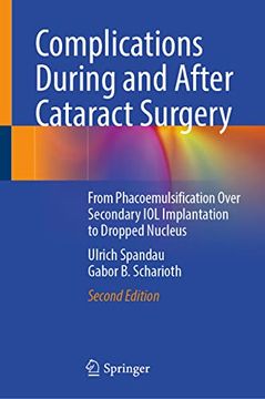 portada Complications During and After Cataract Surgery: From Phacoemulsification Over Secondary Iol Implantation to Dropped Nucleus (en Inglés)