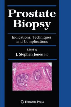 portada prostate biopsy: indications, techniques, and complications (en Inglés)