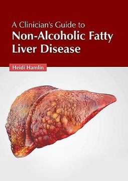 portada A Clinician's Guide to Non-Alcoholic Fatty Liver Disease (en Inglés)