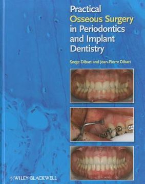 portada practical osseous surgery in periodontics and implant dentistry