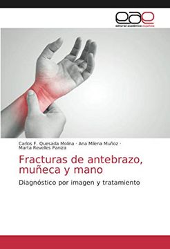 portada Fracturas de Antebrazo, Muñeca y Mano: Diagnóstico por Imagen y Tratamiento (in Spanish)