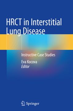 portada Hrct in Interstitial Lung Disease: Instructive Case Studies (en Inglés)