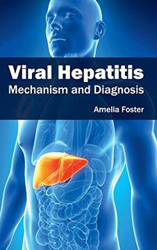 portada Viral Hepatitis: Mechanism and Diagnosis (en Inglés)