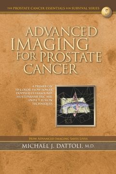 portada Advanced Imaging for Prostate Cancer: A Primer on 3D Color-Flow Power Doppler Ultrasound, Multiparametric MRI and CT Fusion Techniques (en Inglés)