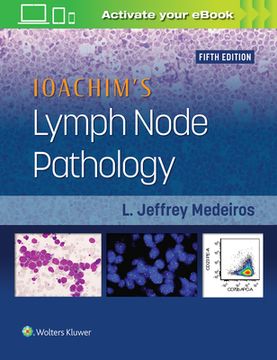 Ioachim's Lymph Node Pathology (en Inglés)