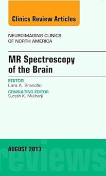 portada Mr Spectroscopy of the Brain, an Issue of Neuroimaging Clinics (Volume 23-3) (The Clinics: Radiology, Volume 23-3) (in English)