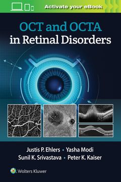 portada Oct and Octa in Retinal Disorders (en Inglés)