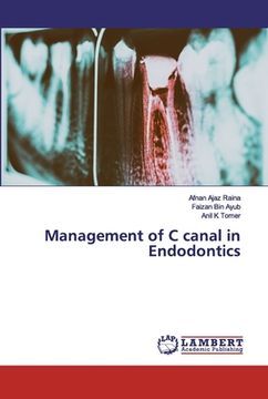 portada Management of C canal in Endodontics