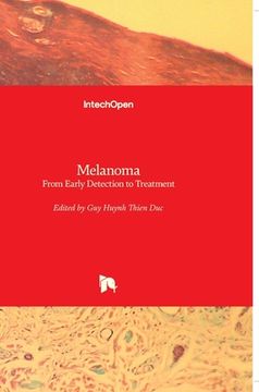 portada Melanoma: From Early Detection to Treatment (en Inglés)