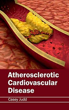portada Atherosclerotic Cardiovascular Disease (in English)