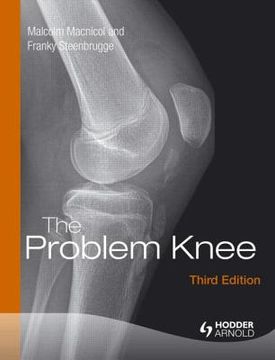 portada The Problem Knee