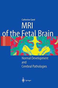 portada 1. Garel, c. - Imagerie du Cerveau Foetal Pathologique2. Garel, c. - Developpement du Cerveau Foetal