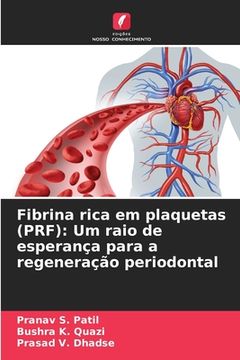 portada Fibrina rica em plaquetas (PRF): Um raio de esperança para a regeneração periodontal (in Portuguese)