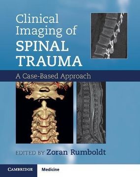 portada Clinical Imaging of Spinal Trauma: A Case-Based Approach 