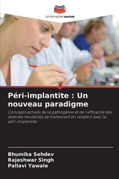 portada Péri-implantite: Un nouveau paradigme (en Francés)