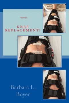 portada Read This BEFORE Your Knee Replacement (en Inglés)