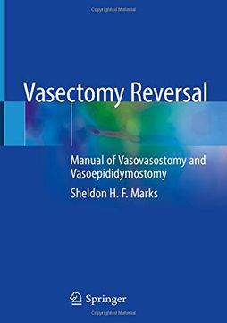 portada Vasectomy Reversal: Manual of Vasovasostomy and Vasoepididymostomy (en Inglés)