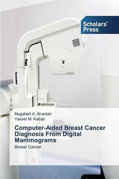 portada Computer-Aided Breast Cancer Diagnosis From Digital Mammograms