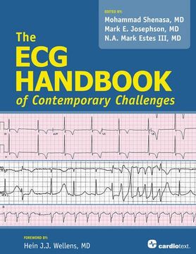 portada Ecg Handbook of Contemporary Challenges (en Inglés)