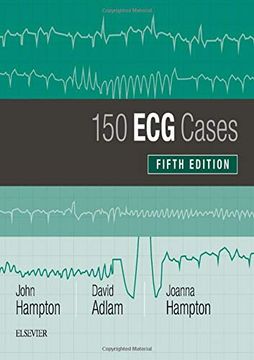 portada 150 ecg Cases, 5e (in English)