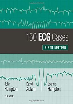 portada 150 ecg Cases, 5e 