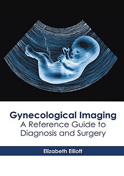 portada Gynecological Imaging: A Reference Guide to Diagnosis and Surgery (en Inglés)