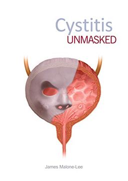portada Cystitis Unmasked (en Inglés)