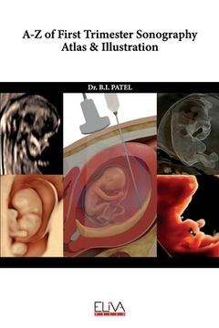 portada A-z of First Trimester Sonography Atlas & Illustration (in English)
