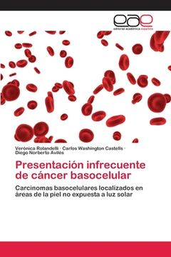 portada Presentación Infrecuente de Cáncer Basocelular: Carcinomas Basocelulares Localizados en Áreas de la Piel no Expuesta a luz Solar (in Spanish)