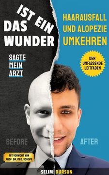 portada Das Ist Ein Wunder Sagte Mein Arzt: Haarverlust Und Alopezie Umkehren (en Alemán)