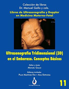 portada Ultrasonografia Tridimensional en el Embarazo (3D). Conceptos Básicos: 11 (Coleccion de Libros dr. Manuel Gallo y Cols) (in Spanish)