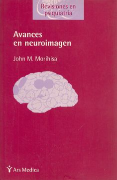 portada Avances en Neuroimagen (in Spanish)