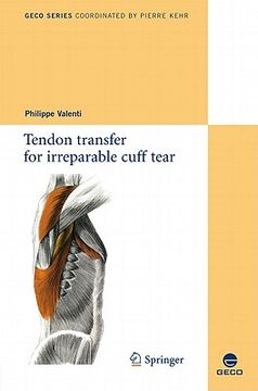 portada tendon transfer for irreparable cuff tear (en Inglés)