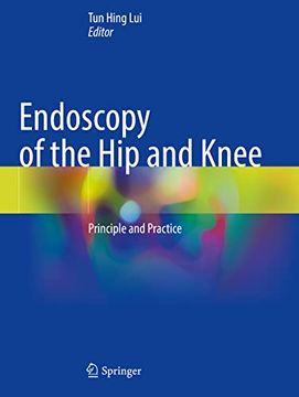 portada Endoscopy of the Hip and Knee: Principle and Practice