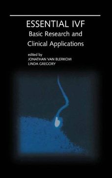 portada Essential Ivf: Basic Research and Clinical Applications 
