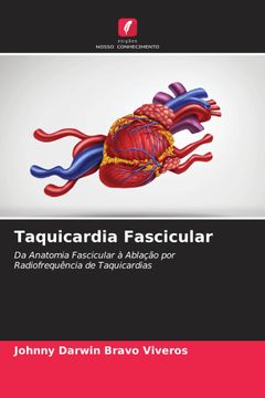 portada Taquicardia Fascicular (in Portuguese)